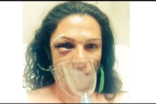 Agreden a Ana Gabriela Guevara; graban el ataque