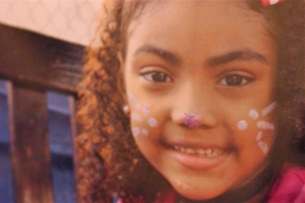 Piden apoyo para salvar la vida de Kimberly