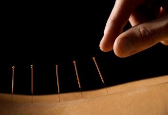 Acupuntura China puede tratar más de 300 enfermedades