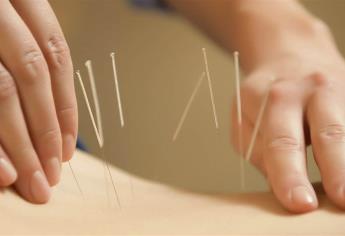 Pacientes con infertilidad buscan ayuda en la acupuntura