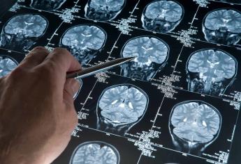 Desarrollan proteína para tratamiento de Alzheimer