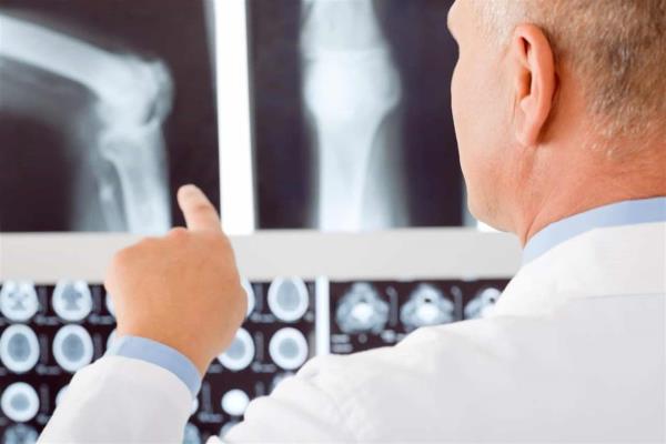 Osteoporosis cuesta a México más de 400 millones de dólares anuales