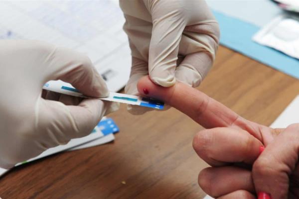 Población de entre 25 y 39 años, la más susceptible de contraer VIH