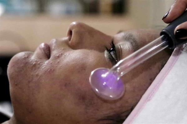 Lupus afecta más a mujeres