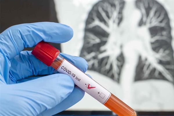 Ricardo y su esposa tienen coronavirus, llaman a evitar el contagio