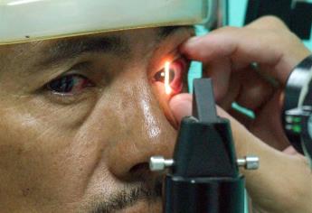 El glaucoma es la primera causa de ceguera en México