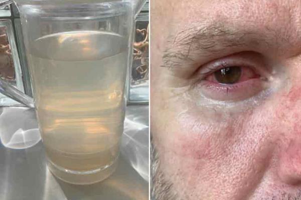 Denuncia estadounidense haberse contagiado de toxoplasmosis por agua contaminada