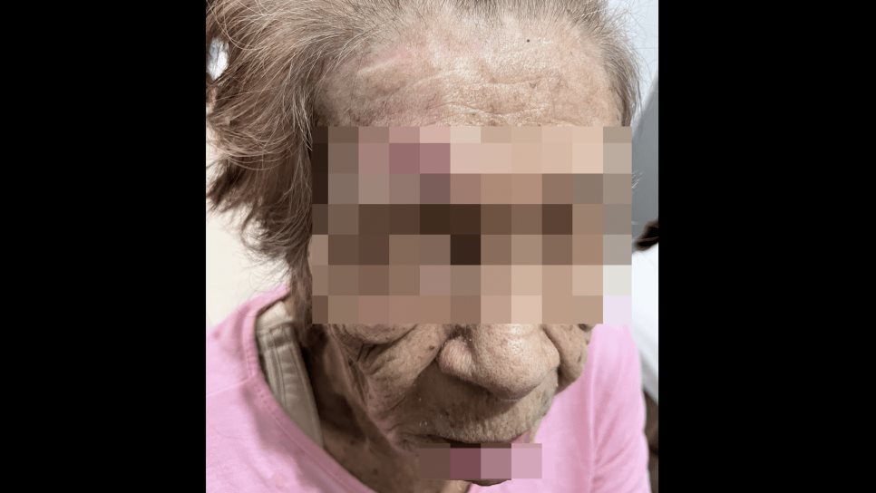 Denuncian negligencia en asilo por heridas graves a abuelita