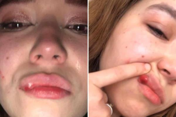 Joven mujer fue golpeada por un hombre tras concierto de Carín León en Los Mochis