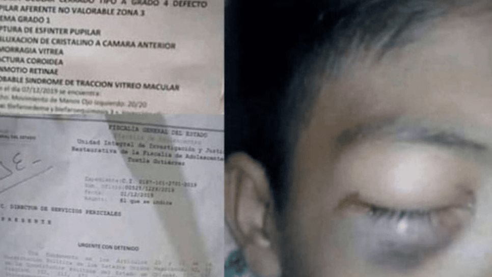 Propinan brutal golpiza a estudiante de secundaria