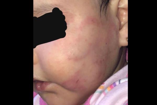 Fue por su bebé a la guardia y la encontró golpeada del rostro; ocurrió en Mazatlán 