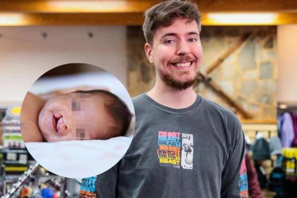 Youtuber Mr. Beast regala 100 cirugías a niños con labio leporino en México