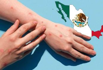 Mpox en México: ¿Cuántos casos hay y en qué estados?