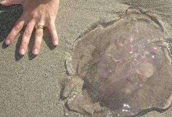 ¿Te quemó una aguamala en la playa? Esto es lo que uno debes hacer para no incrementar el dolor