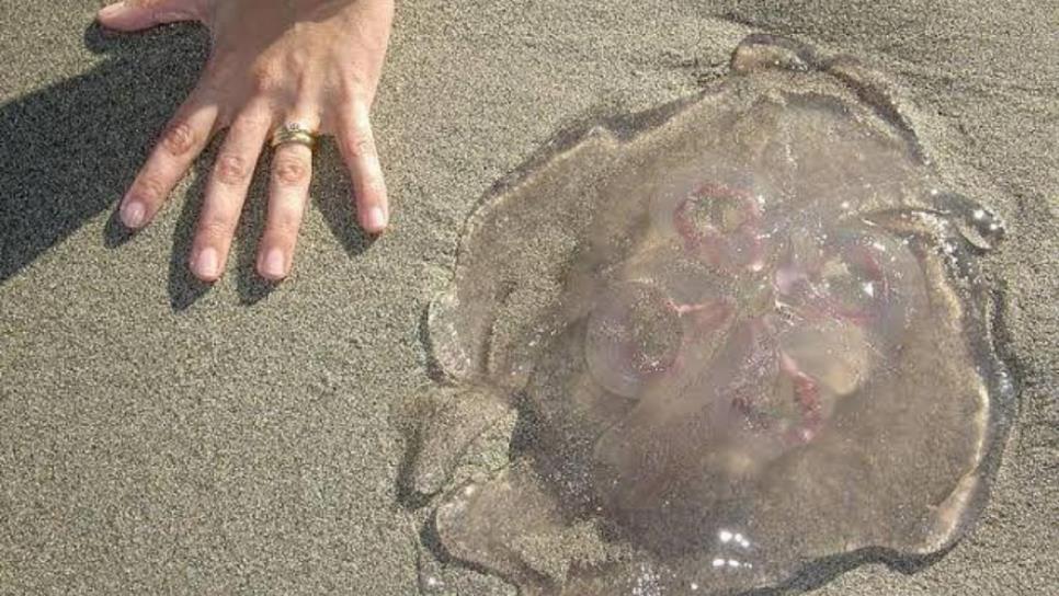 ¿Te quemó una aguamala en la playa? Esto es lo que uno debes hacer para no incrementar el dolor ¿Te quemó una aguamala en la playa? Esto es lo que uno debes hacer para no incrementar el dolor