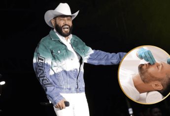 Pancho Barraza se da una retocadita en el rosto; La belleza duele poquito | VIDEO