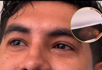 David Macías, joven mazatleco de 28 años, lucha contra el cáncer ocular y pide apoyo para costear su cirugía 