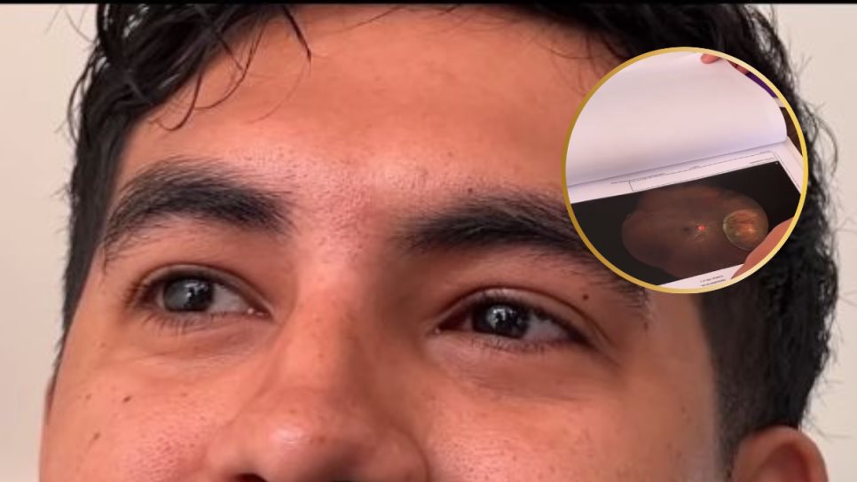 David Macías, joven mazatleco de 28 años, lucha contra el cáncer ocular y pide apoyo para costear su cirugía David Macías, joven mazatleco de 28 años, lucha contra el cáncer ocular y pide apoyo para costear su cirugía
