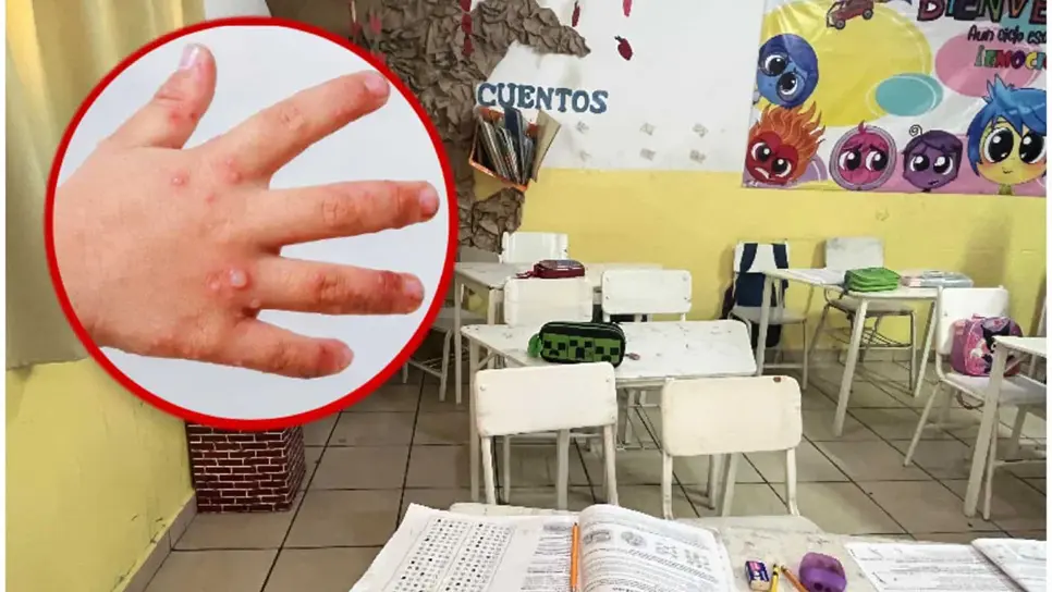 Por brote de virus Coxsackie cierran kinder de Culiacán